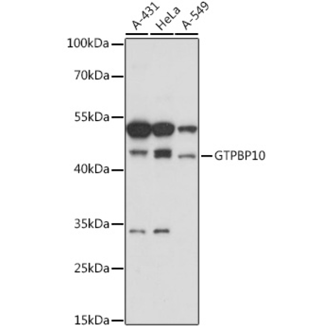 GTPBP10 Rabbit Polyclonal Antibody