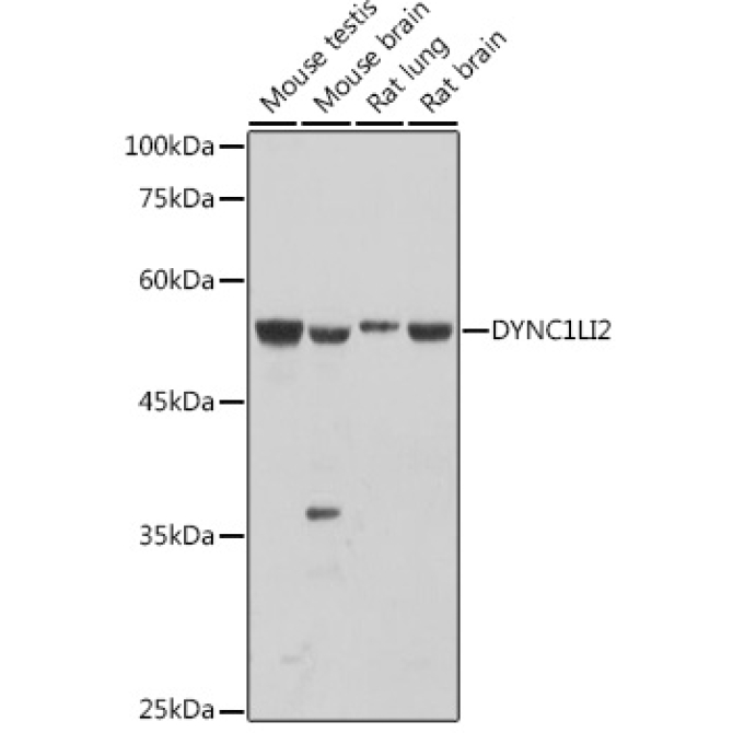 DYNC1LI2 Rabbit Polyclonal Antibody