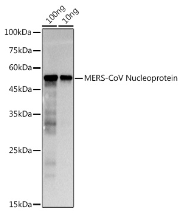 MERS-CoV Nucleoprotein Rabbit Polyclonal Antibody