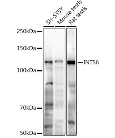 INTS6 Rabbit Polyclonal Antibody