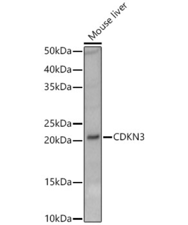 CDKN3 Rabbit Polyclonal Antibody