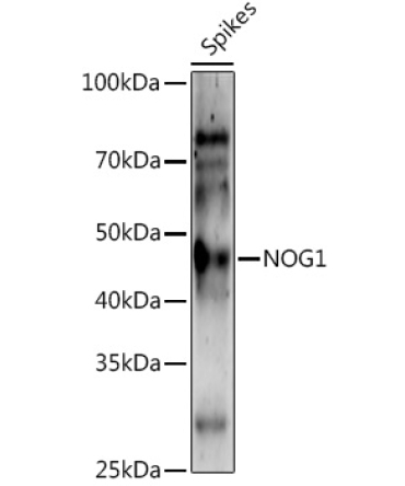 NOG1 Rabbit Polyclonal Antibody
