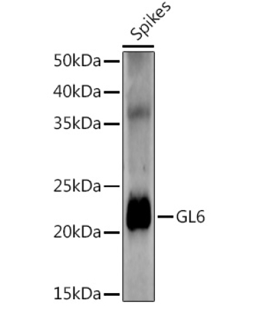 GL6 Rabbit Polyclonal Antibody