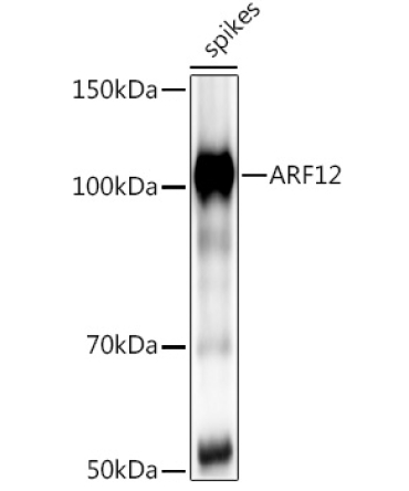 ARF12 Rabbit Polyclonal Antibody