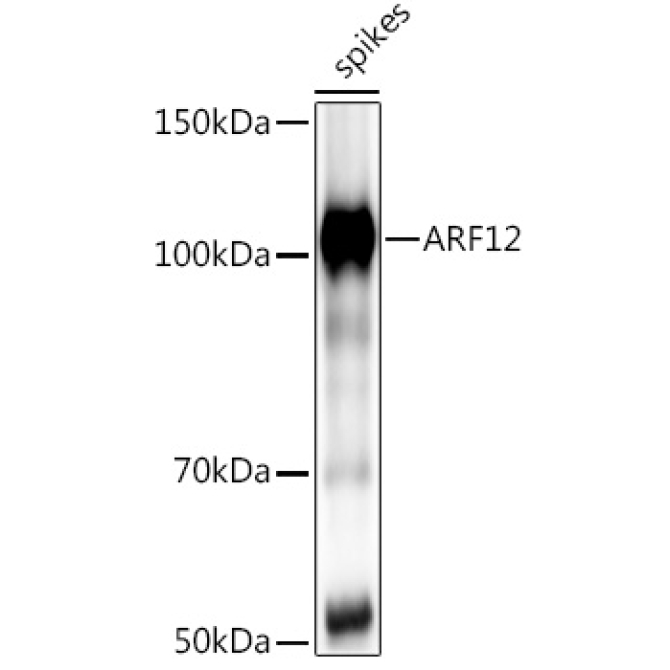 ARF12 Rabbit Polyclonal Antibody