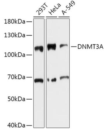DNMT3A Rabbit Polyclonal Antibody