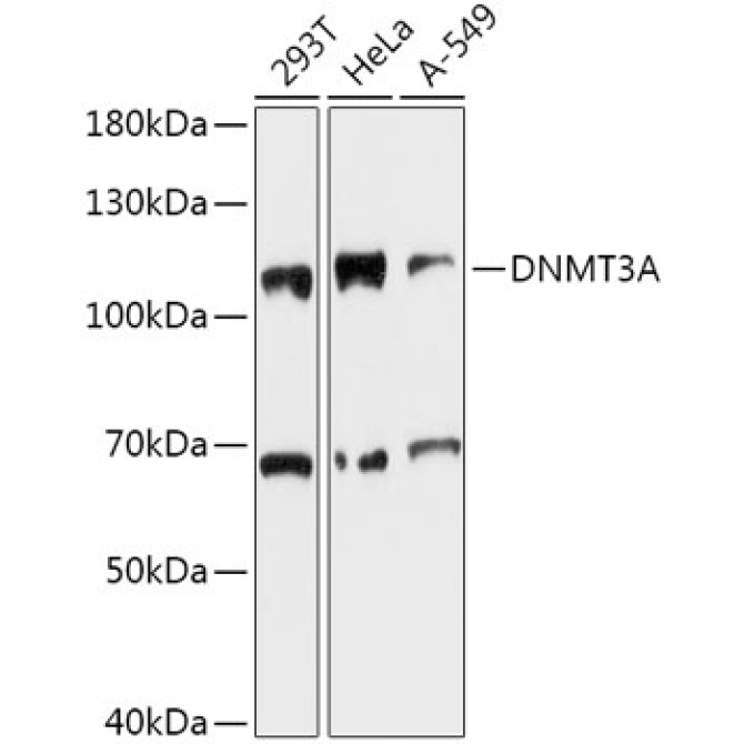 DNMT3A Rabbit Polyclonal Antibody