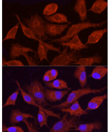 CYP4F11 Rabbit Polyclonal Antibody