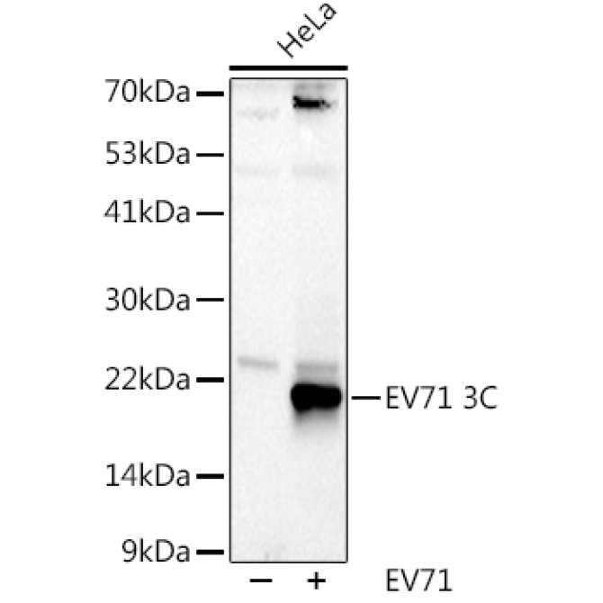 EV71 3C Rabbit Polyclonal Antibody