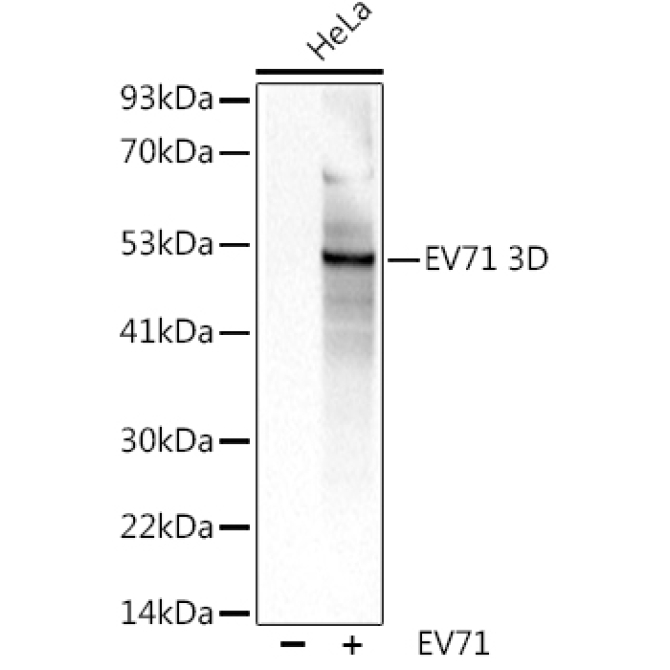 EV71 3D Rabbit Polyclonal Antibody