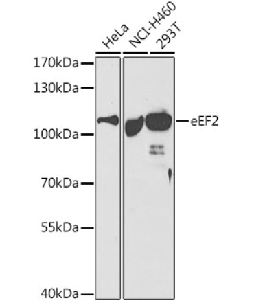 eEF2 Rabbit Polyclonal Antibody