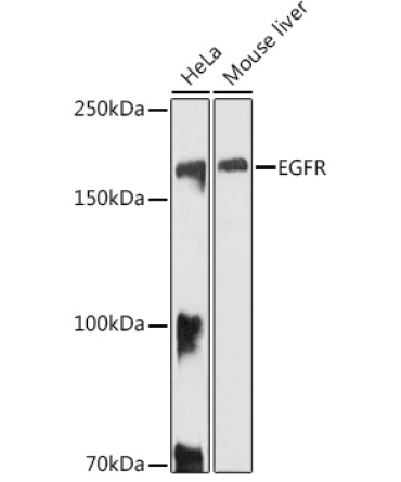 EGFR Rabbit Polyclonal Antibody