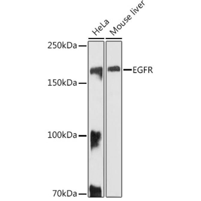EGFR Rabbit Polyclonal Antibody