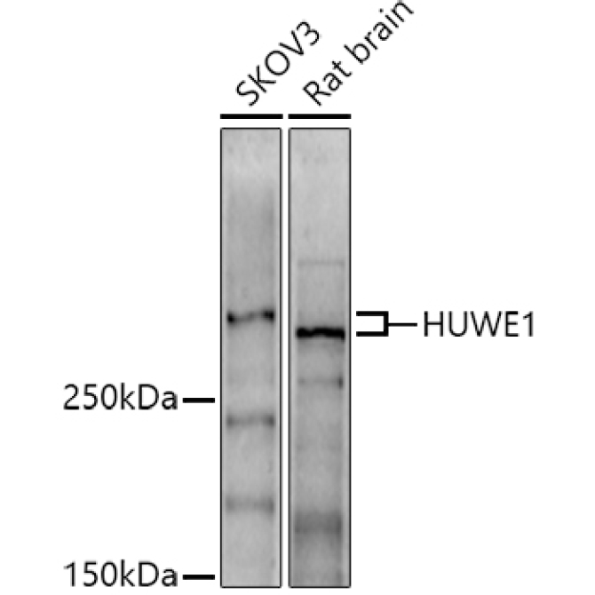 HUWE1 Rabbit Polyclonal Antibody
