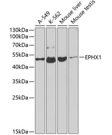 EPHX1 Rabbit Polyclonal Antibody