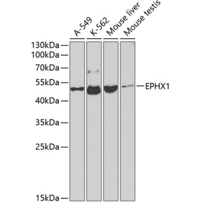 EPHX1 Rabbit Polyclonal Antibody