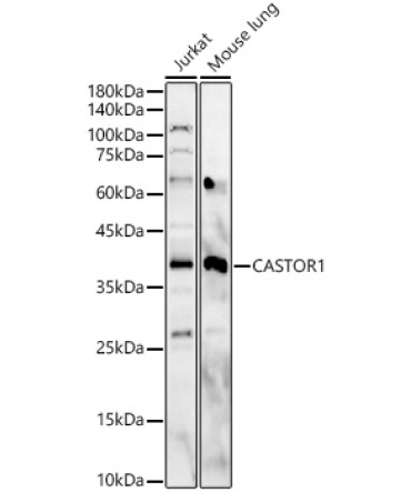 CASTOR1 Rabbit Polyclonal Antibody