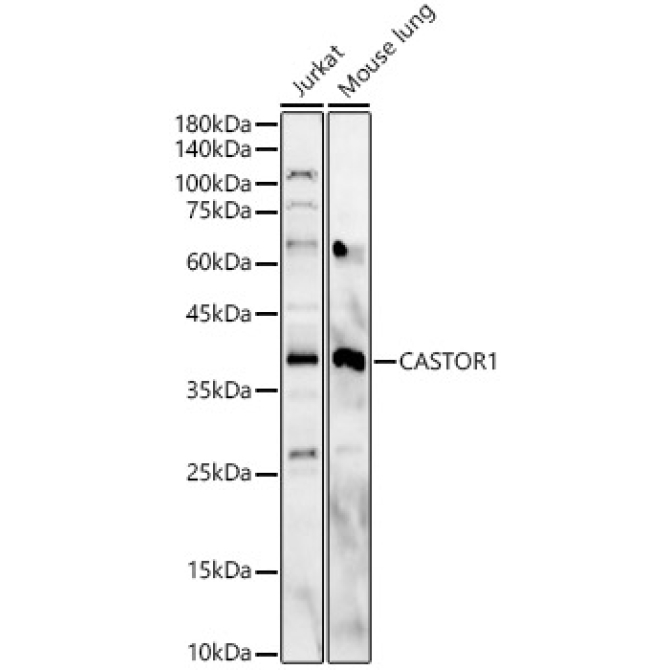 CASTOR1 Rabbit Polyclonal Antibody