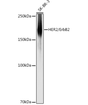 HER2/ErbB2 Rabbit Polyclonal Antibody