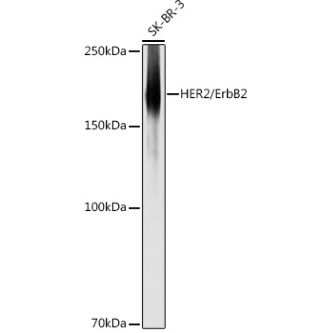 HER2/ErbB2 Rabbit Polyclonal Antibody