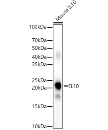 IL10 Rabbit Polyclonal Antibody