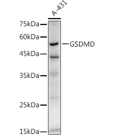 GSDMD (Full length+C terminal) Rabbit Monoclonal Antibody