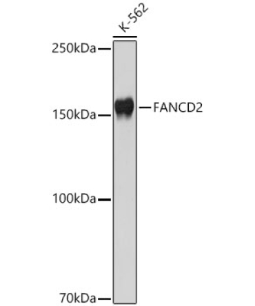 FANCD2 Rabbit Polyclonal Antibody