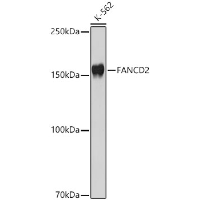 FANCD2 Rabbit Polyclonal Antibody