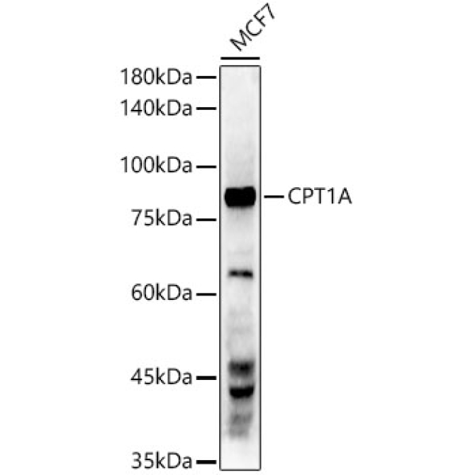 CPT1A Rabbit Monoclonal Antibody