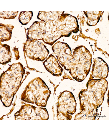 FGFR2 Rabbit Polyclonal Antibody