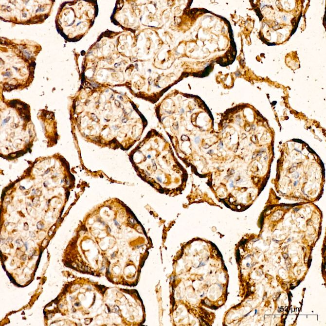 FGFR2 Rabbit Polyclonal Antibody