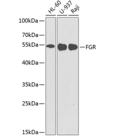FGR Rabbit Polyclonal Antibody