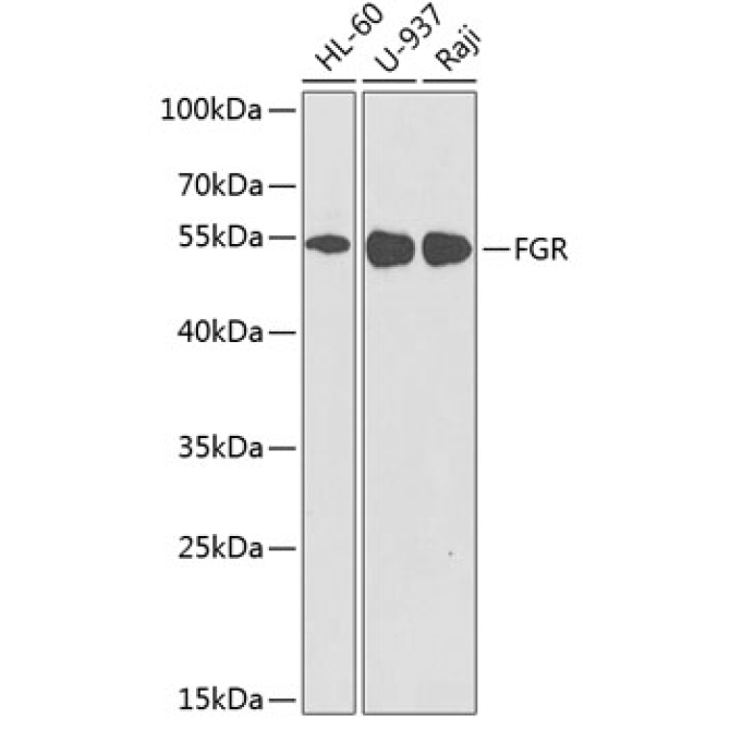 FGR Rabbit Polyclonal Antibody