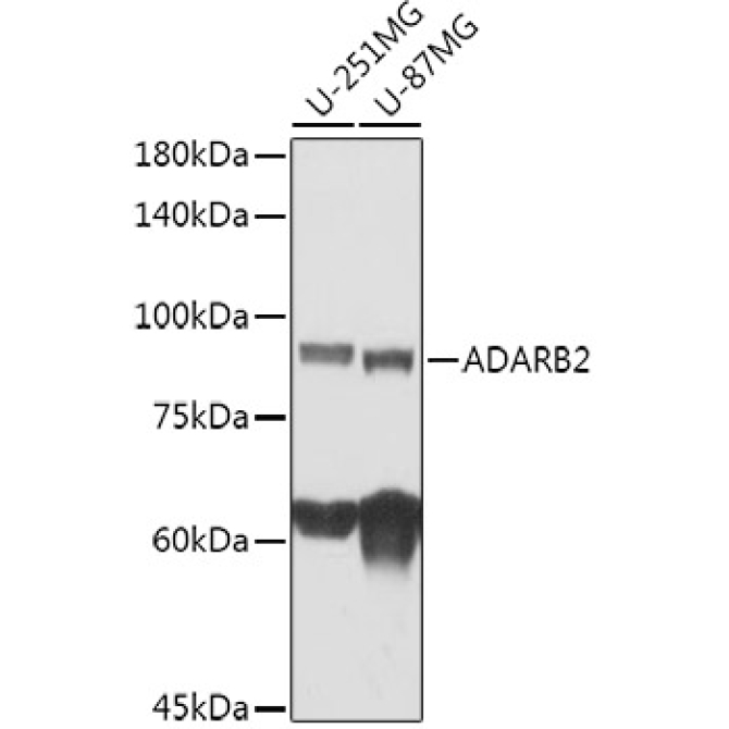 ADARB2 Rabbit Polyclonal Antibody