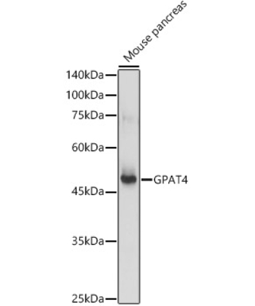GPAT4 Rabbit Polyclonal Antibody
