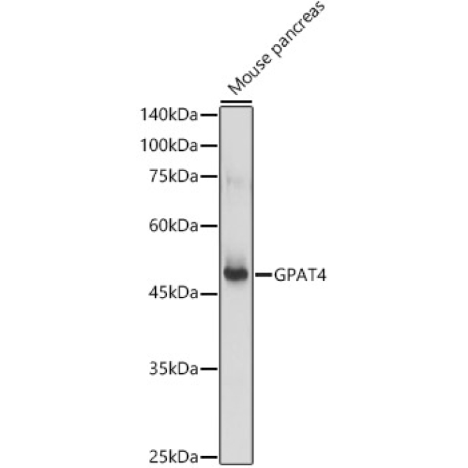 GPAT4 Rabbit Polyclonal Antibody