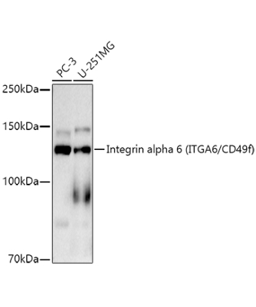 Integrin alpha 6 (ITGA6/CD49f) Rabbit Monoclonal Antibody