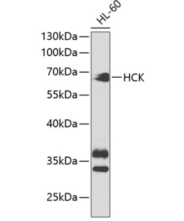 HCK Rabbit Polyclonal Antibody