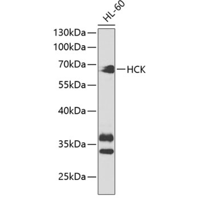 HCK Rabbit Polyclonal Antibody