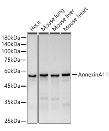 Annexin A11  Rabbit Monoclonal Antibody
