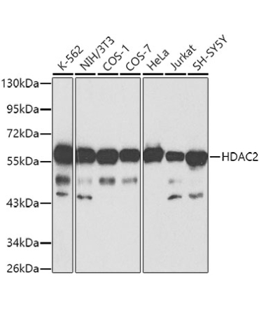 HDAC2 Rabbit Polyclonal Antibody