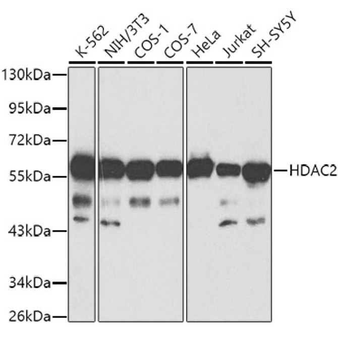 HDAC2 Rabbit Polyclonal Antibody