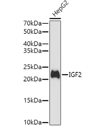 IGF2 Rabbit Polyclonal Antibody