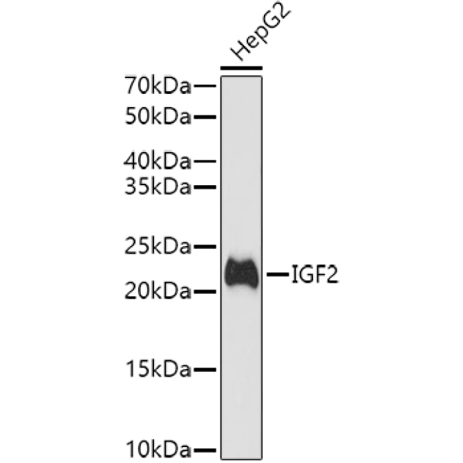IGF2 Rabbit Polyclonal Antibody
