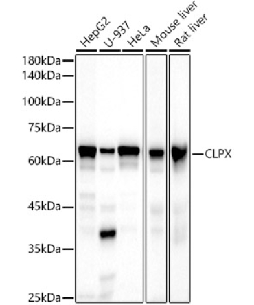 CLPX Rabbit Monoclonal Antibody