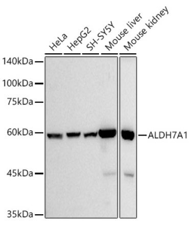 ALDH7A1 Rabbit Monoclonal Antibody