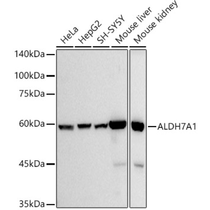 ALDH7A1 Rabbit Monoclonal Antibody