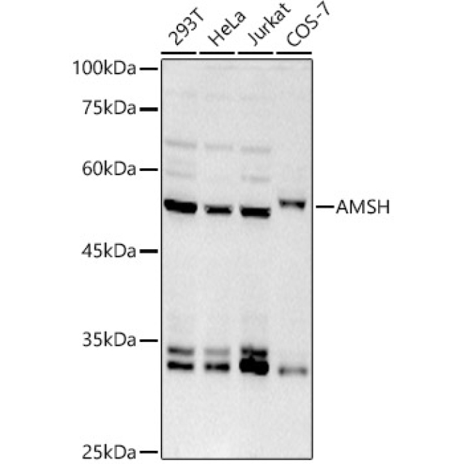AMSH Rabbit Monoclonal Antibody