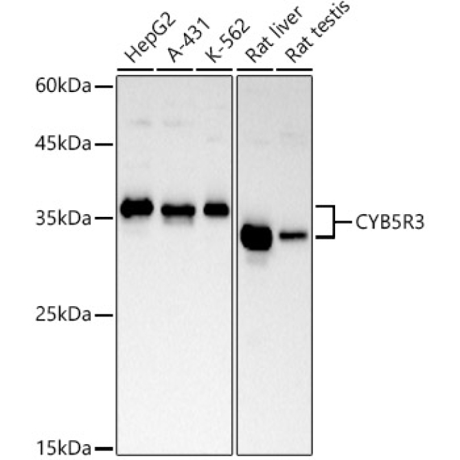 CYB5R3 Rabbit Monoclonal Antibody