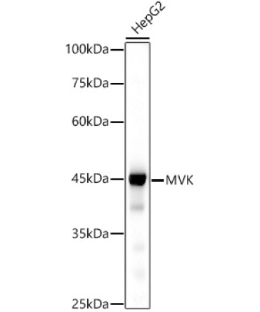 MVK Rabbit Monoclonal Antibody
